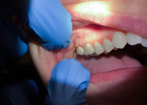 Best Emergency Gum Pain Relief  in Russell, KS