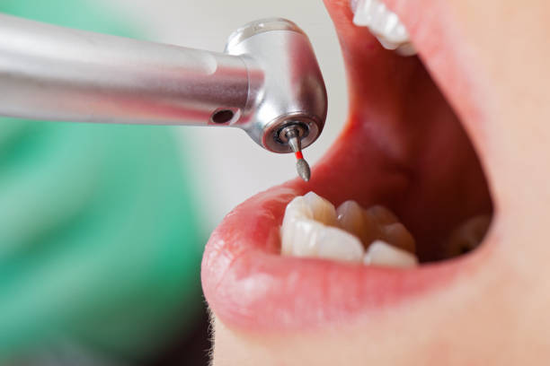 Best Root Canal Emergency Dentist  in Russell, KS